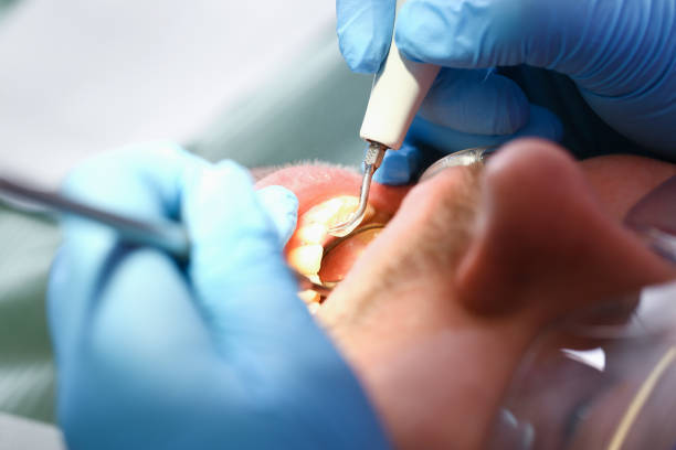Best Emergency Denture Repair in Bassett, VA