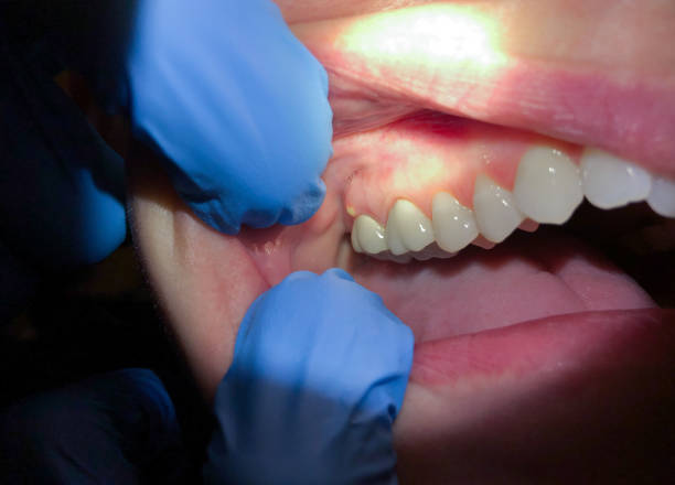 Best Emergency TMJ Treatment in Bassett, VA